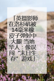 英摄影师在洛杉矶被14毫米橡皮子弹射中大腿 当地华人：像误闯“末日生存”游戏